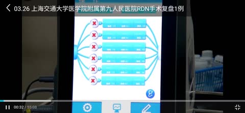 rdn设备